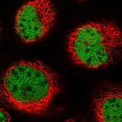 APRIN Antibody, Novus Biologicals 0.1mL; Unlabeled:Antibodies, Polyclonal